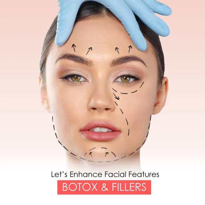 b@t@x fillers treatment