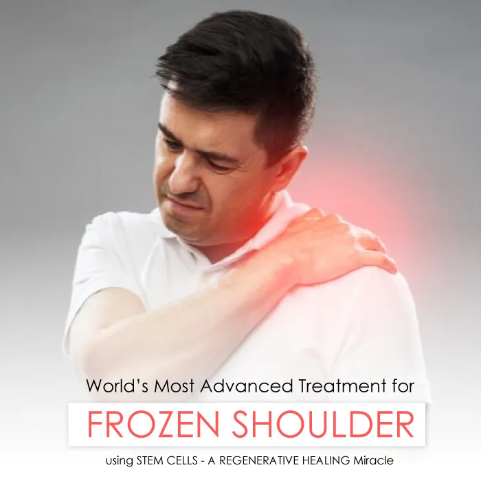 frozen shoulder treatment