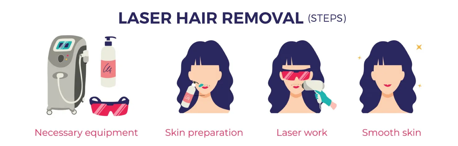 laser hair removal steps