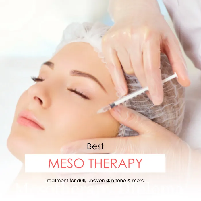 mesotherapy treatment