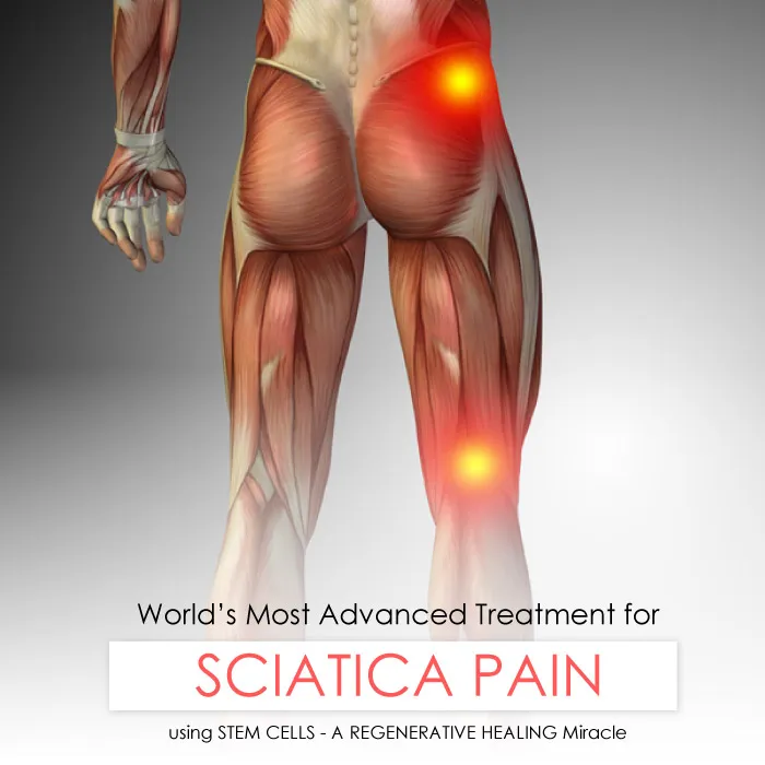 Sciatica Pain Treatment