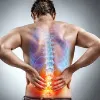 Sciatica Pain