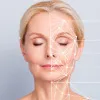 wrinkles fine lines b@t@x filler