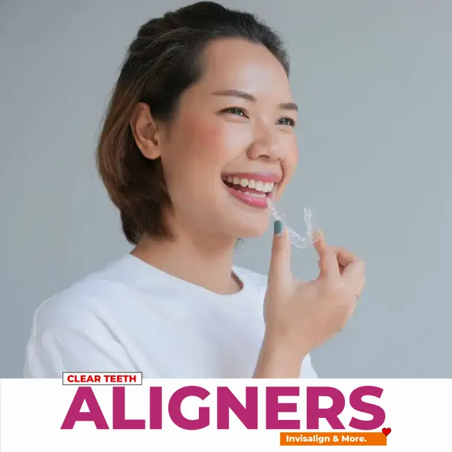 teeth aligners
